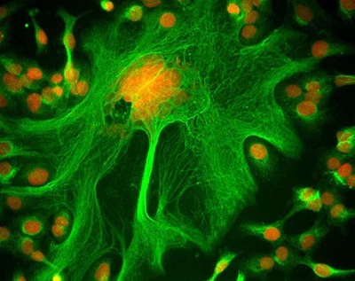 Calcium imaging featured image
